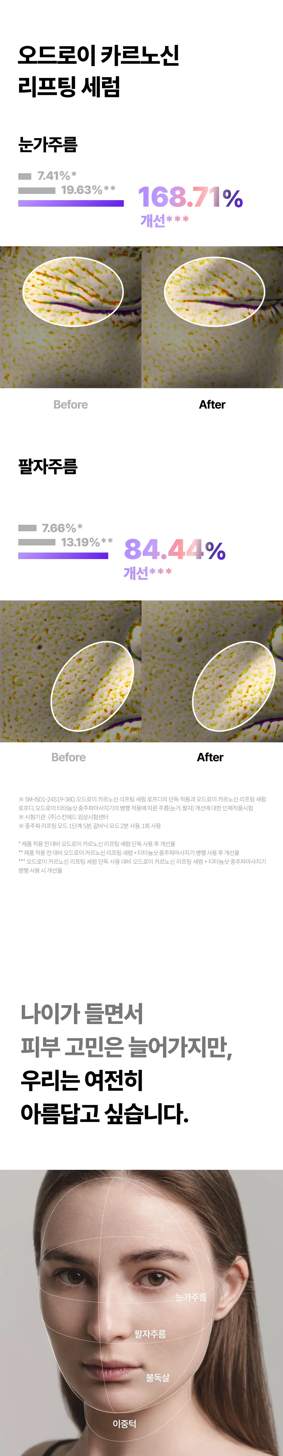 [이중턱/윤곽] 오드로이 모공수축 중주파마사지기 티타늄샷 기획(+모공수축크림 100ml 본품 증정) 상세페이지 4